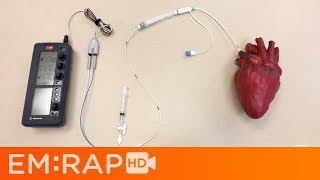 Placing a Transvenous Pacemaker [upl. by Manoop]