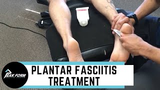 Top 10 Ways To Cure Plantar Fasciitis [upl. by Coralyn]