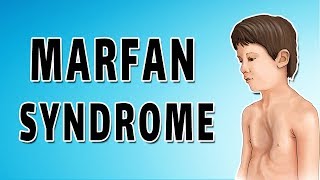 Marfan Syndrome [upl. by Bebe]