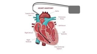 Pacemaker Issues Explained Part 2 Decoding Undersensing [upl. by Niraj189]