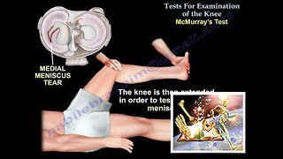 Tests For Examination Of The Knee  Everything You Need To Know  Dr Nabil Ebraheim [upl. by Anelram398]