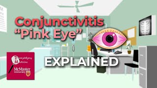 Conjunctivitis Pink Eye Explained [upl. by Bushey122]