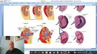 Trauma in Arabic 34  Spleen Injuries   by Dr Wahdan [upl. by Eppes171]