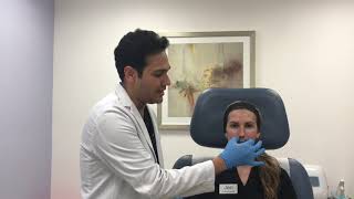 Botox treatment for gummy smile by Dr Shaun Patel [upl. by Schlenger277]