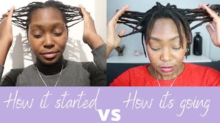 How I Went From Thin To Thick Locs [upl. by Dorree]