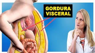 Como Perder Gordura Visceral Rápido  DIMINUA A BARRIGA [upl. by Tay]