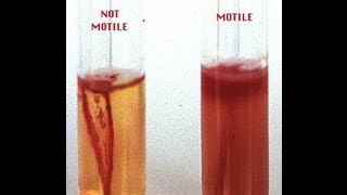 Motility of Vibrio cholerae [upl. by Terry223]