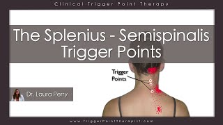 The Splenius and Semispinalis Trigger Points [upl. by Ytok93]