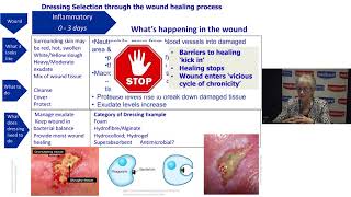 Understanding Wound Dressings Categories and Indications [upl. by Nnylodnewg]