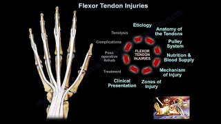 Flexor Tendon Injuries  Everything You Need To Know  Dr Nabil Ebraheim [upl. by Lyall768]