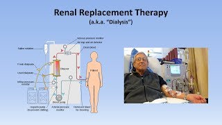 Acute Kidney Injury Part 33  Treatment and Complications [upl. by Kera]