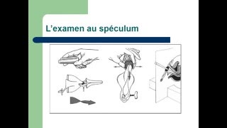 GYNECOLOGIE L’examen en gynécologie [upl. by Ramma]